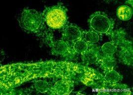 貓傳腹是怎么引起的（罪魁禍首是貓冠狀病毒）